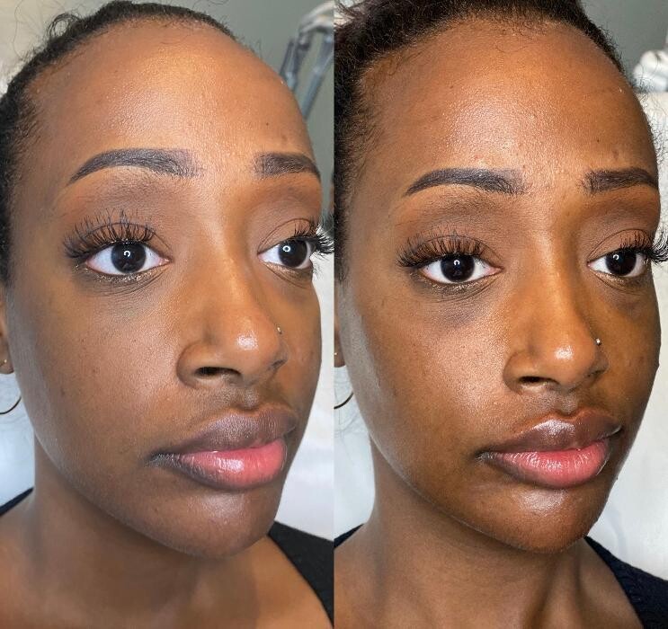 Images Modern You Medical Aesthetics