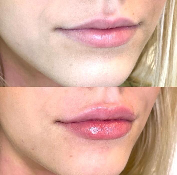 Images Modern You Medical Aesthetics
