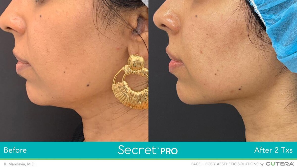 Images Modern You Medical Aesthetics