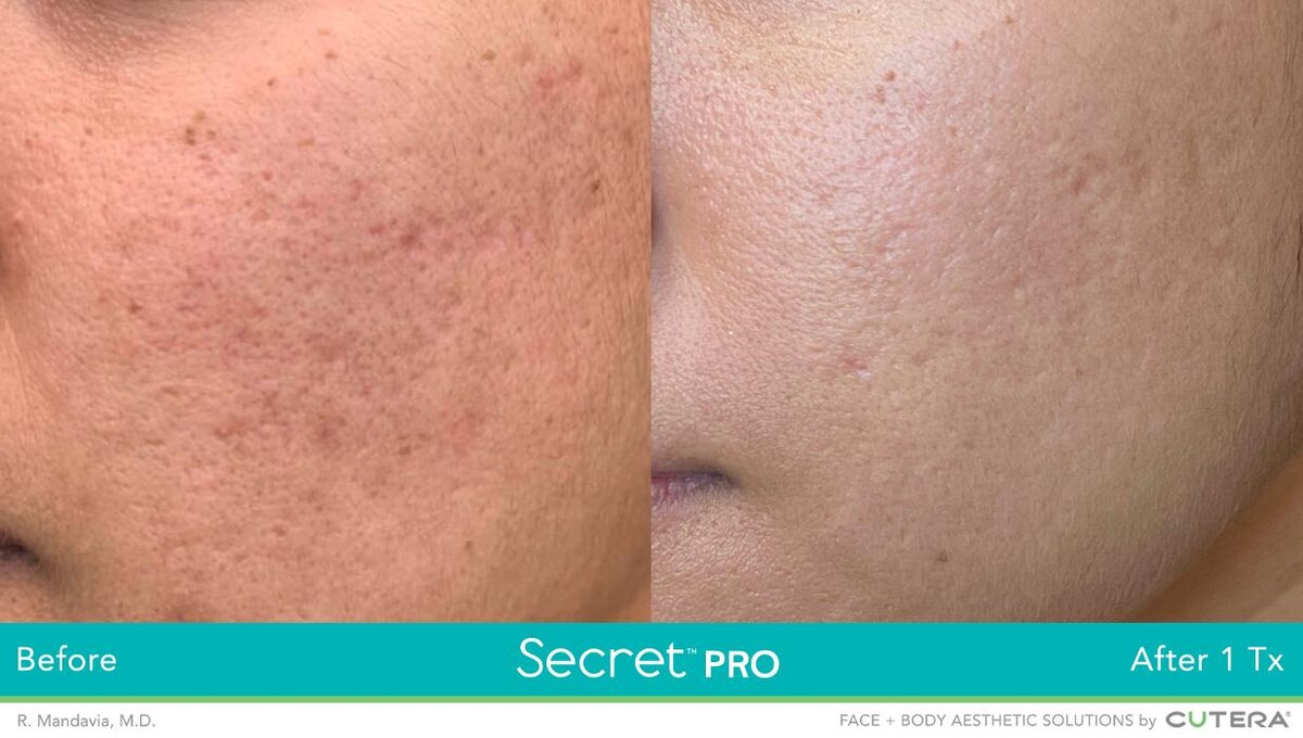Images Modern You Medical Aesthetics
