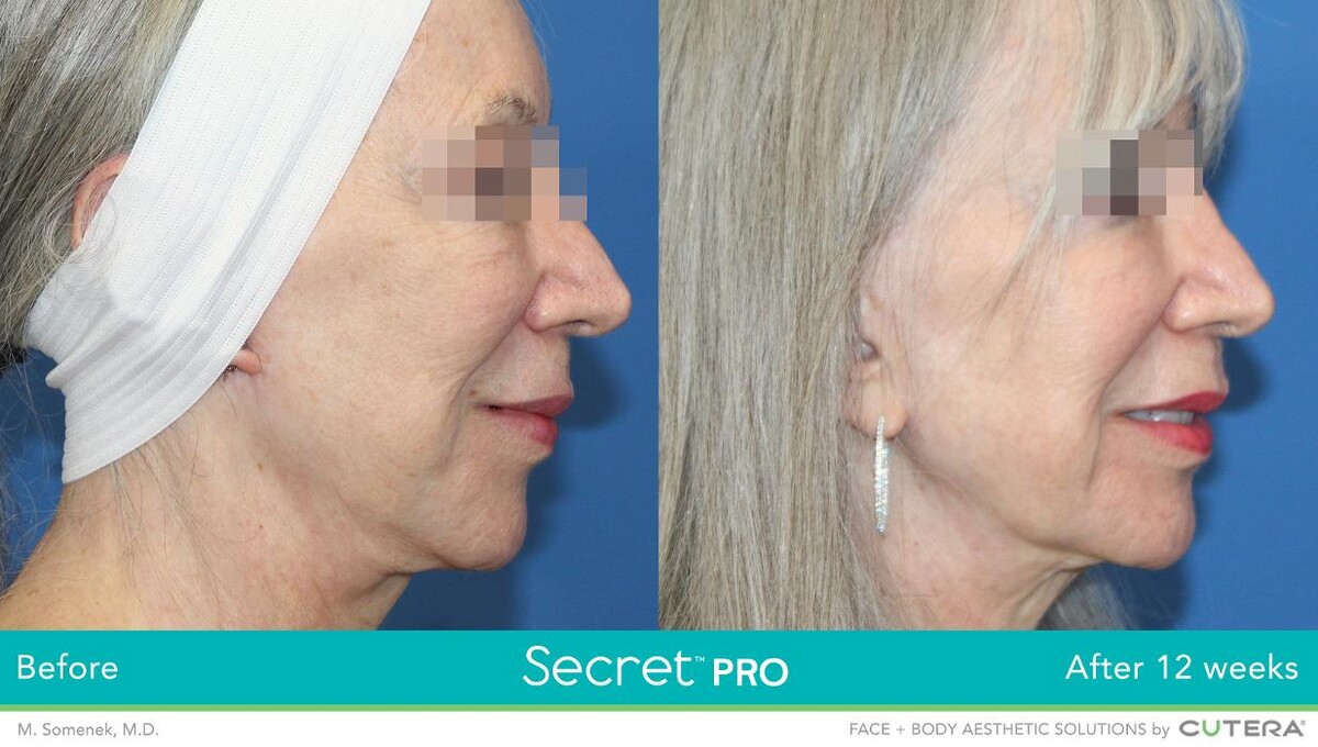 Images Modern You Medical Aesthetics