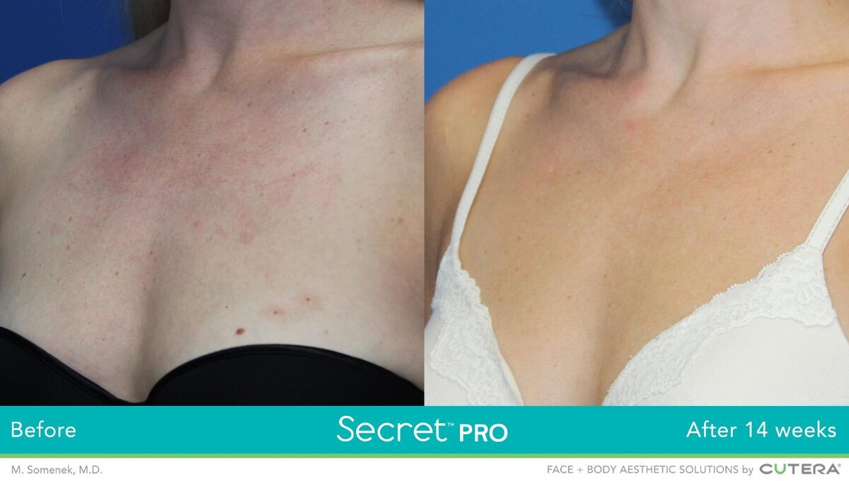Images Modern You Medical Aesthetics