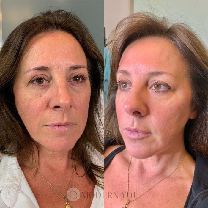 Images Modern You Medical Aesthetics