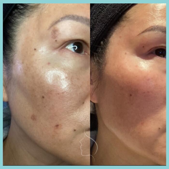 Images Modern You Medical Aesthetics