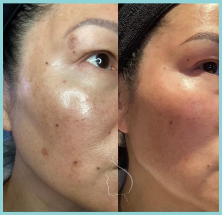 Images Modern You Medical Aesthetics