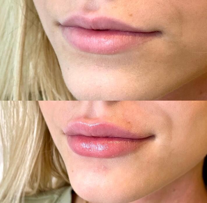 Images Modern You Medical Aesthetics