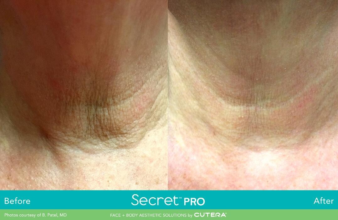 Images Modern You Medical Aesthetics