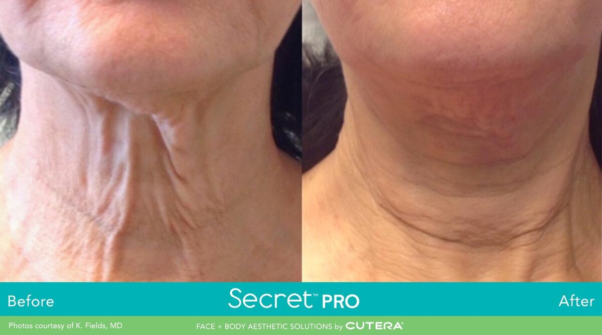 Images Modern You Medical Aesthetics