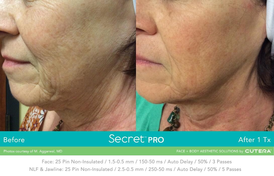 Images Modern You Medical Aesthetics