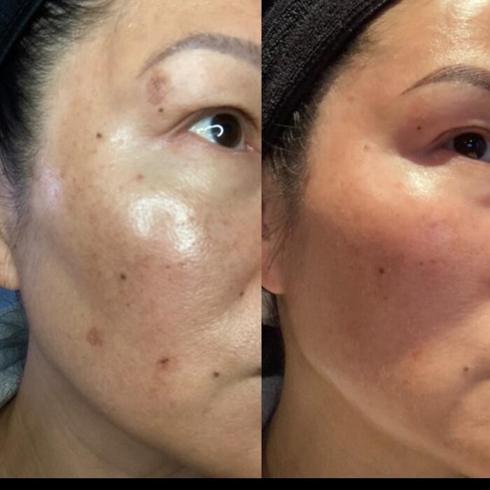 Images Modern You Medical Aesthetics