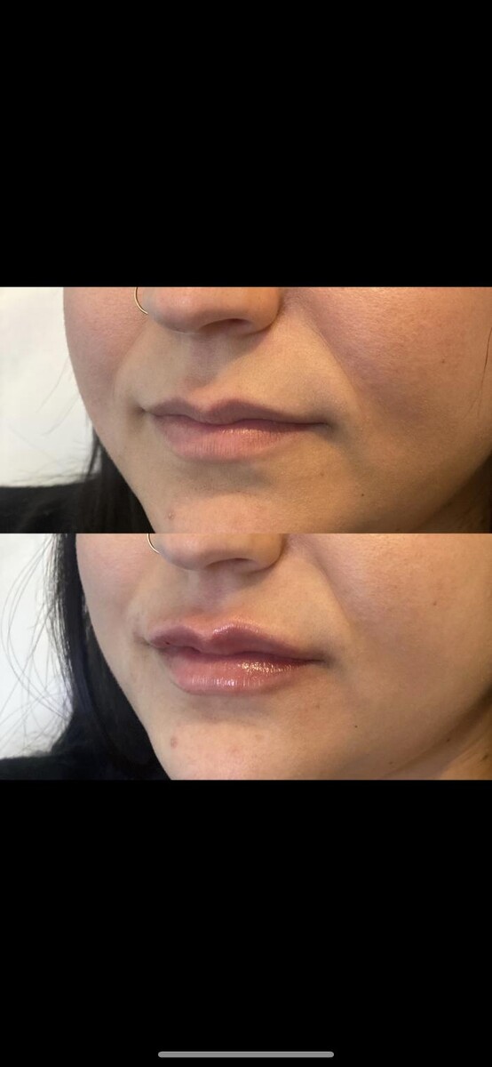 Images Modern You Medical Aesthetics
