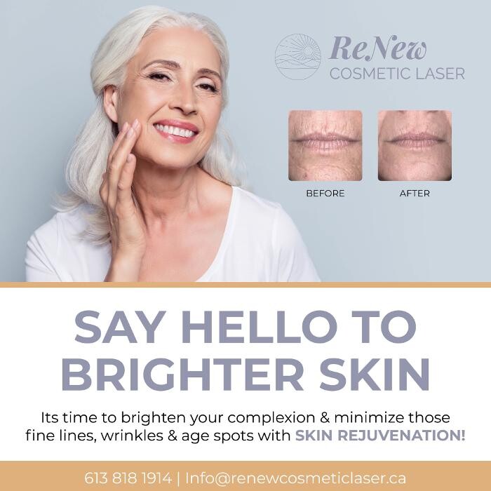 Images ReNew Cosmetic Laser