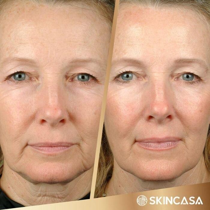 Images SkinCasa