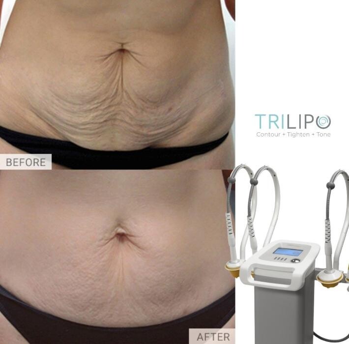 Images Phoenix Revive MedSpa