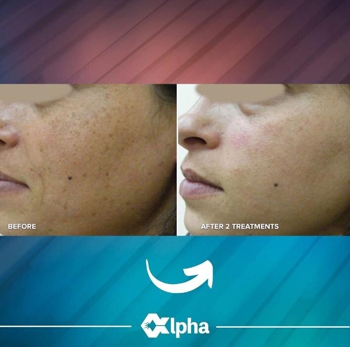 Images Phoenix Revive MedSpa