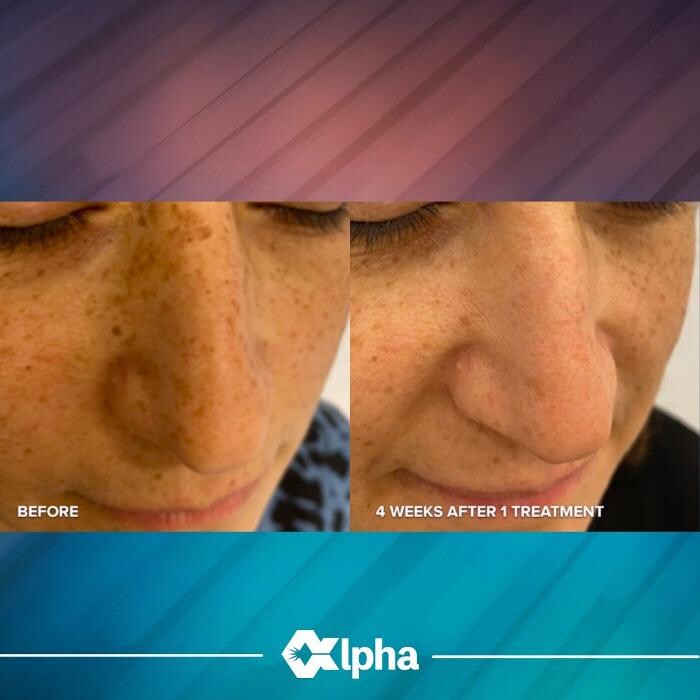 Images Phoenix Revive MedSpa