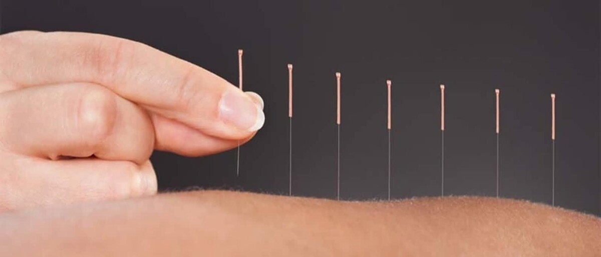 Images Healing Shore Acupuncture & Wellness