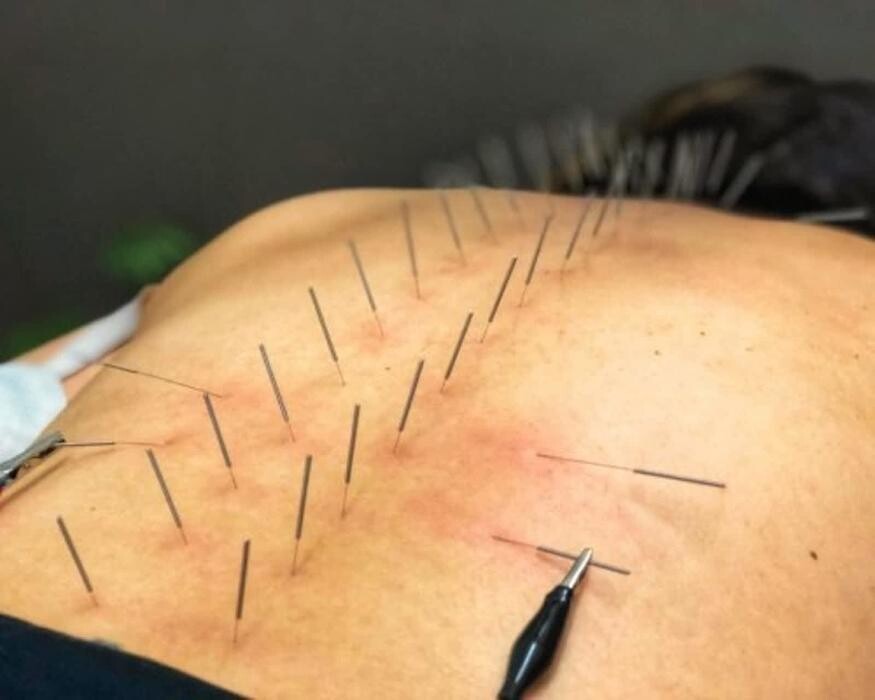 Images Healing Shore Acupuncture & Wellness