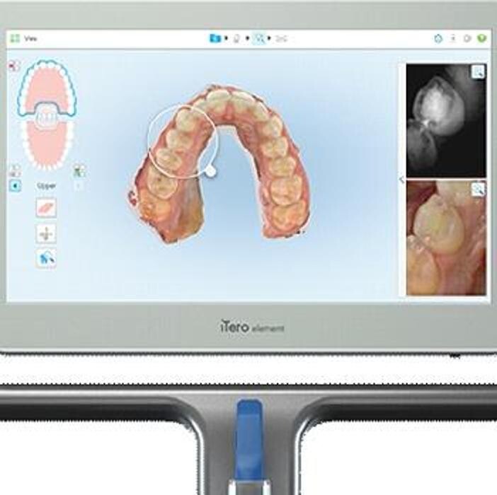 Images Impact Orthodontics SE