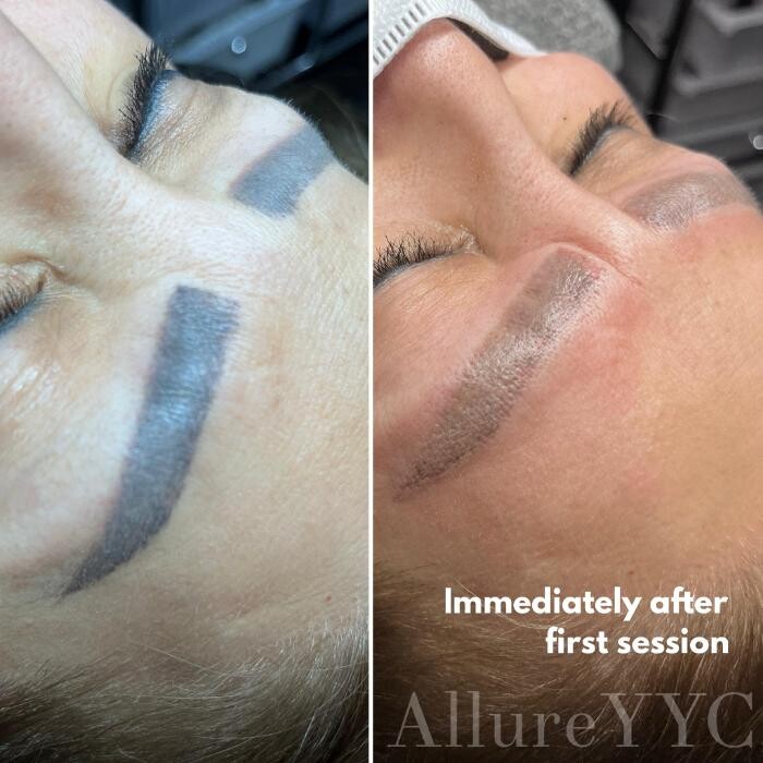 Images Allure YYC