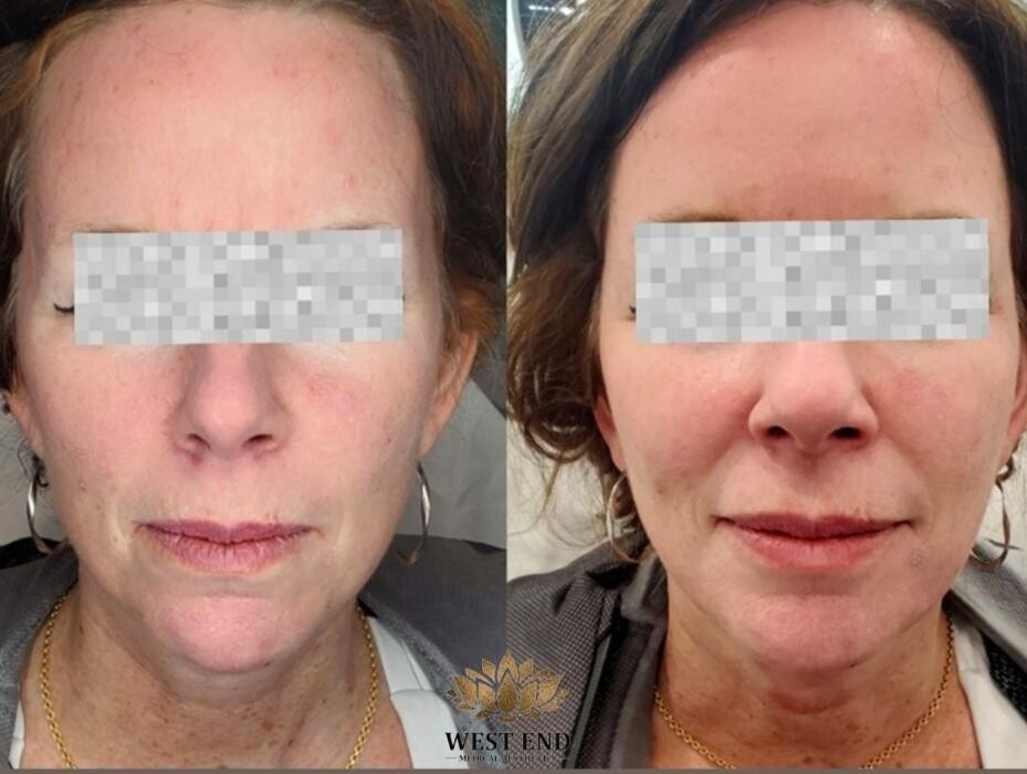 Images West End Medical Aesthetics