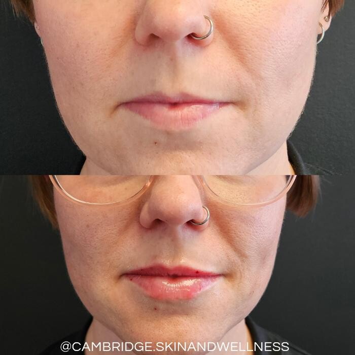 Images Cambridge Skin and Wellness