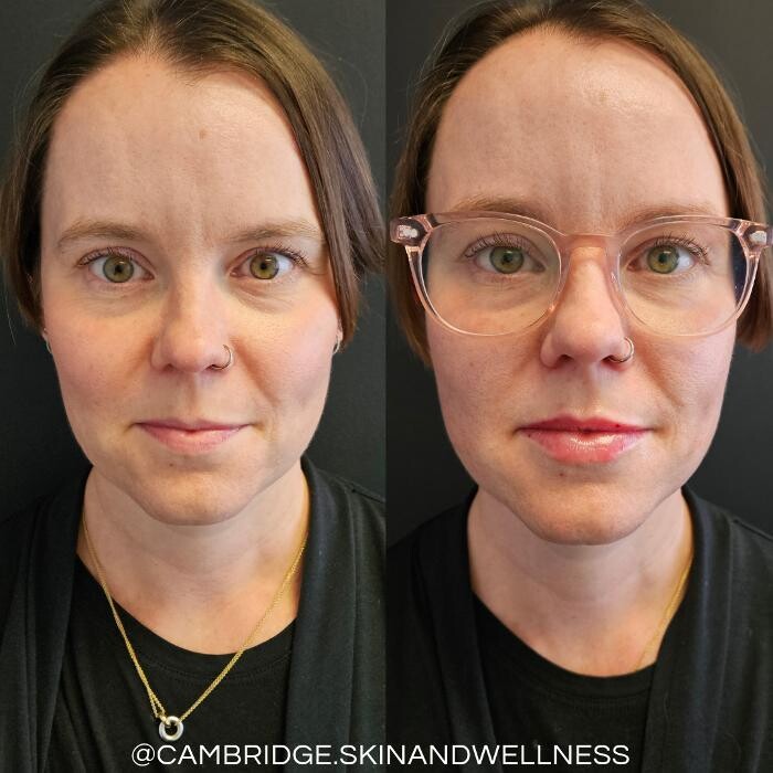 Images Cambridge Skin and Wellness