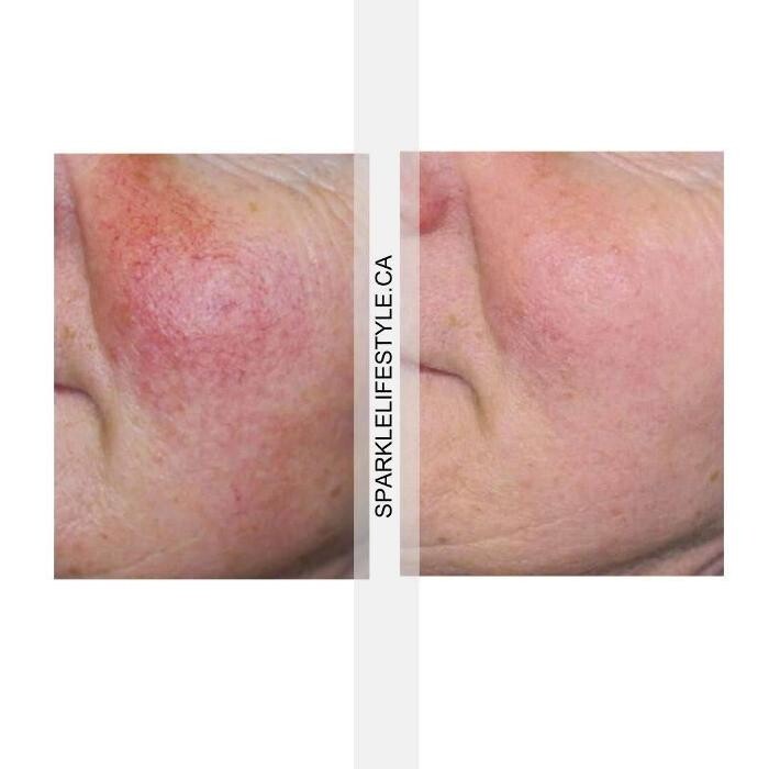 Images Sparkle Lifestyle & MediSpa