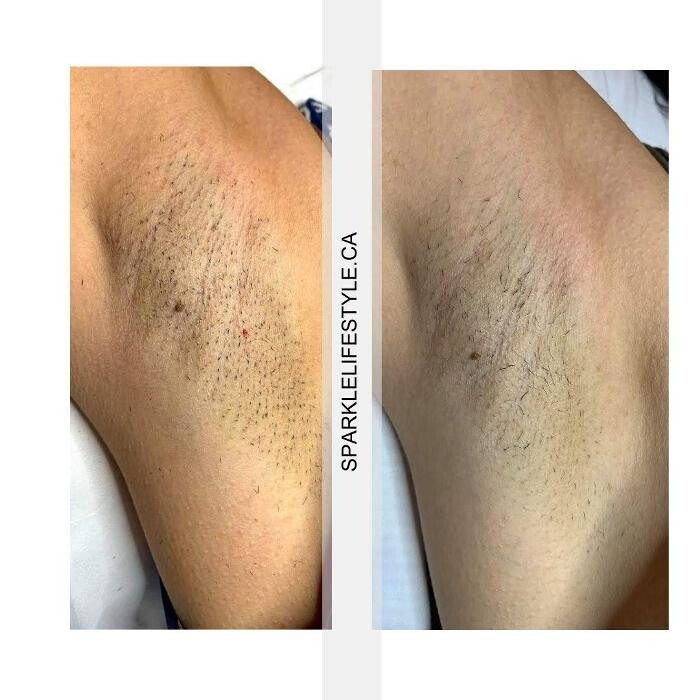 Images Sparkle Lifestyle & MediSpa