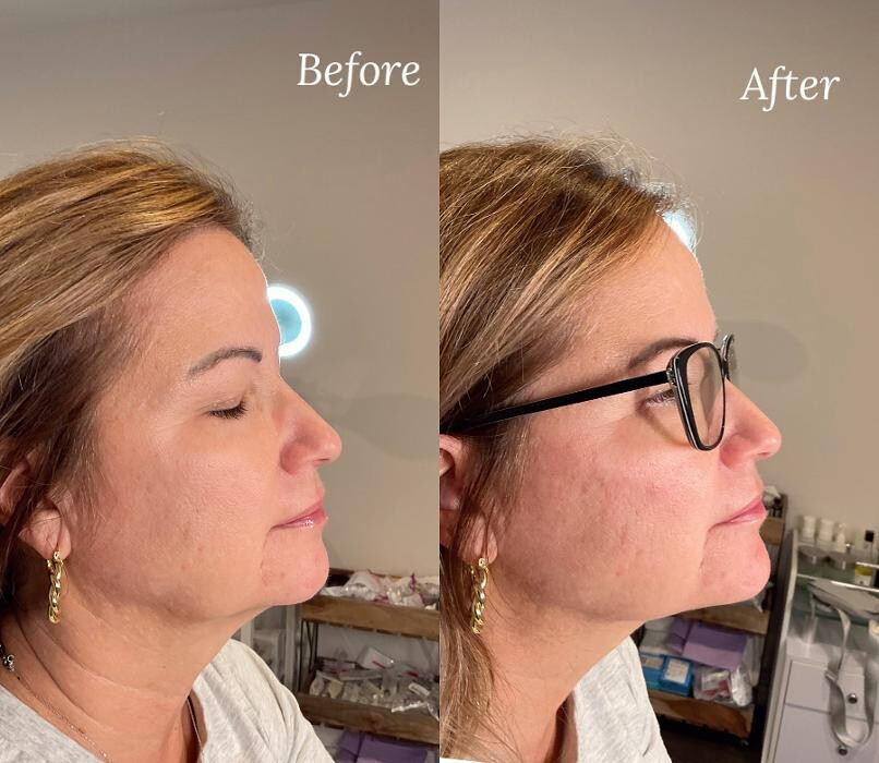 Images Subtle Aesthetics