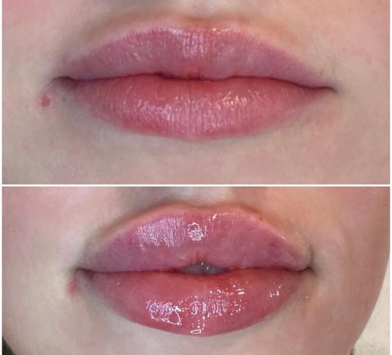 Images Subtle Aesthetics