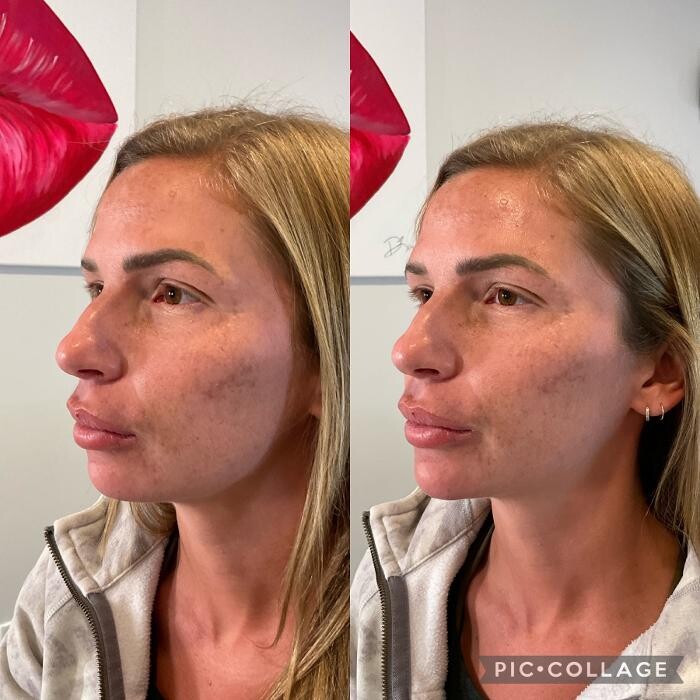 Images Subtle Aesthetics