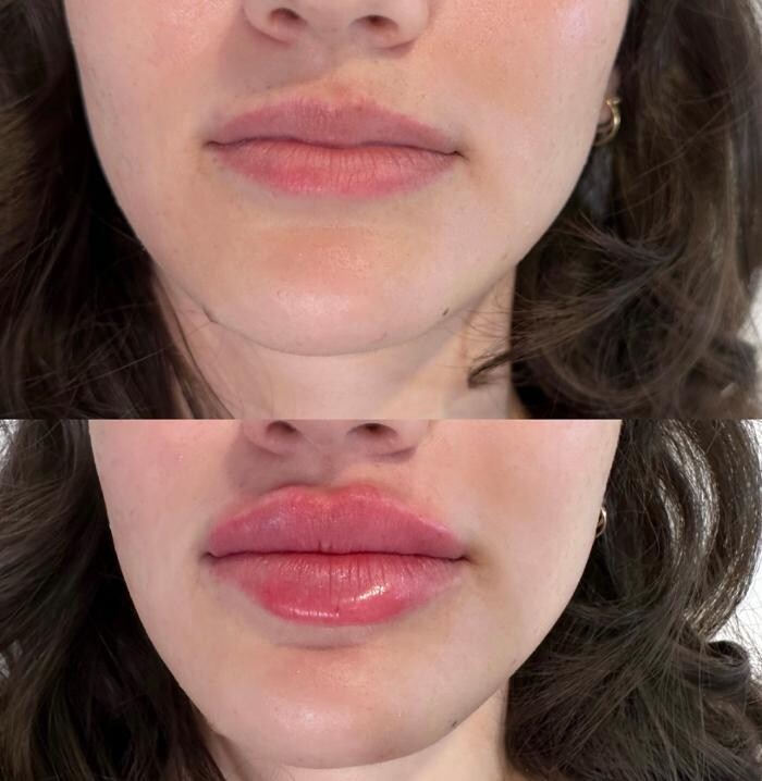 Images Subtle Aesthetics