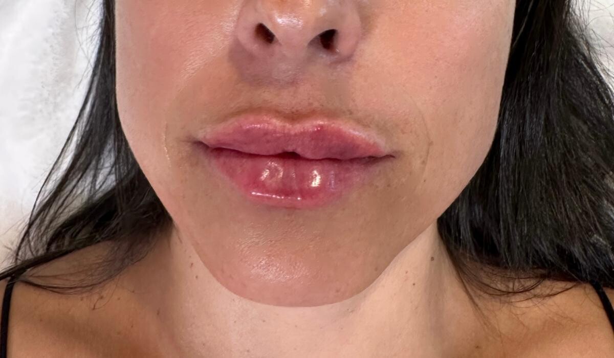 Images Subtle Aesthetics