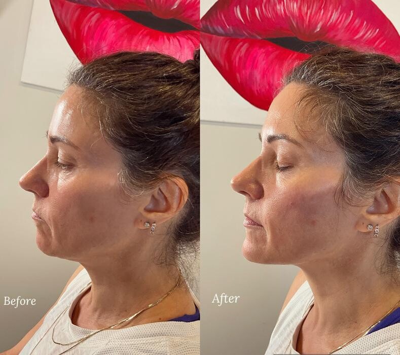 Images Subtle Aesthetics