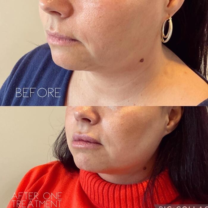 Images Subtle Aesthetics