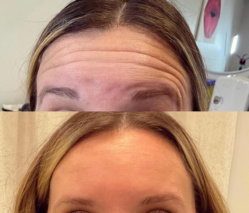 Images Subtle Aesthetics