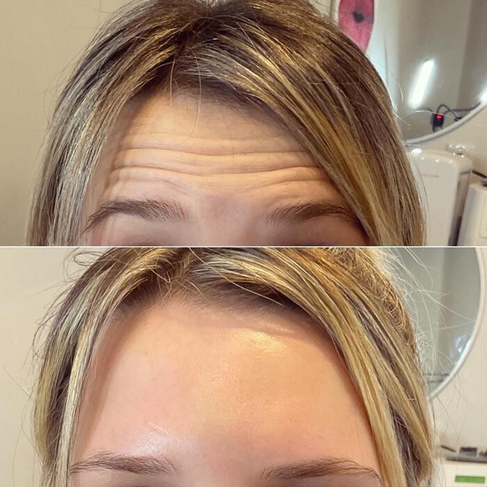 Images Subtle Aesthetics