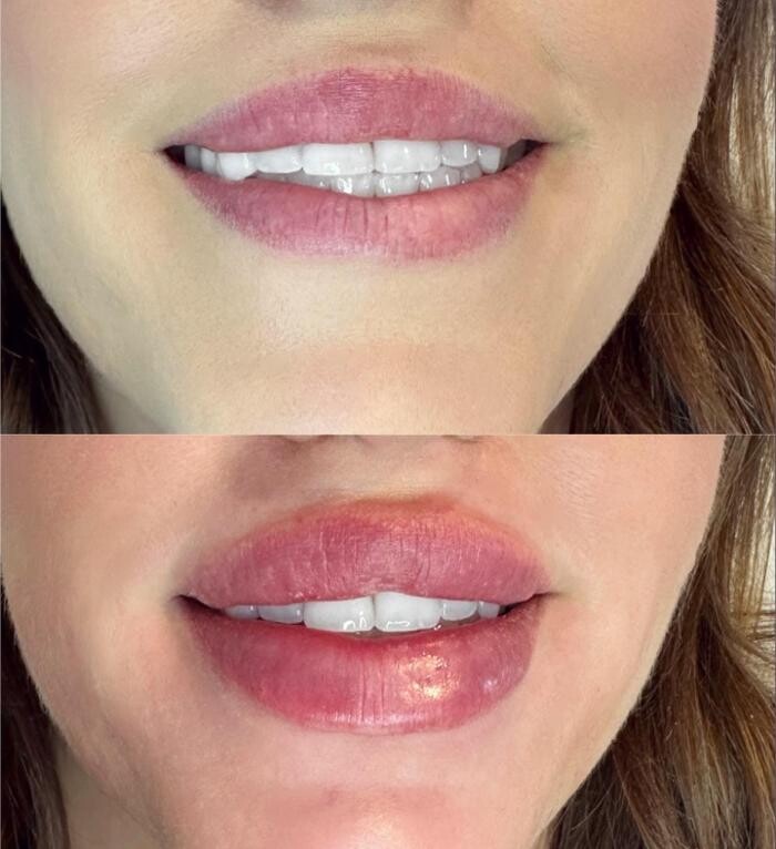 Images Subtle Aesthetics