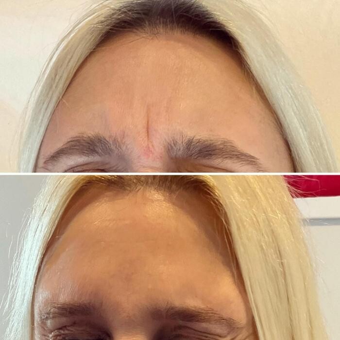 Images Subtle Aesthetics