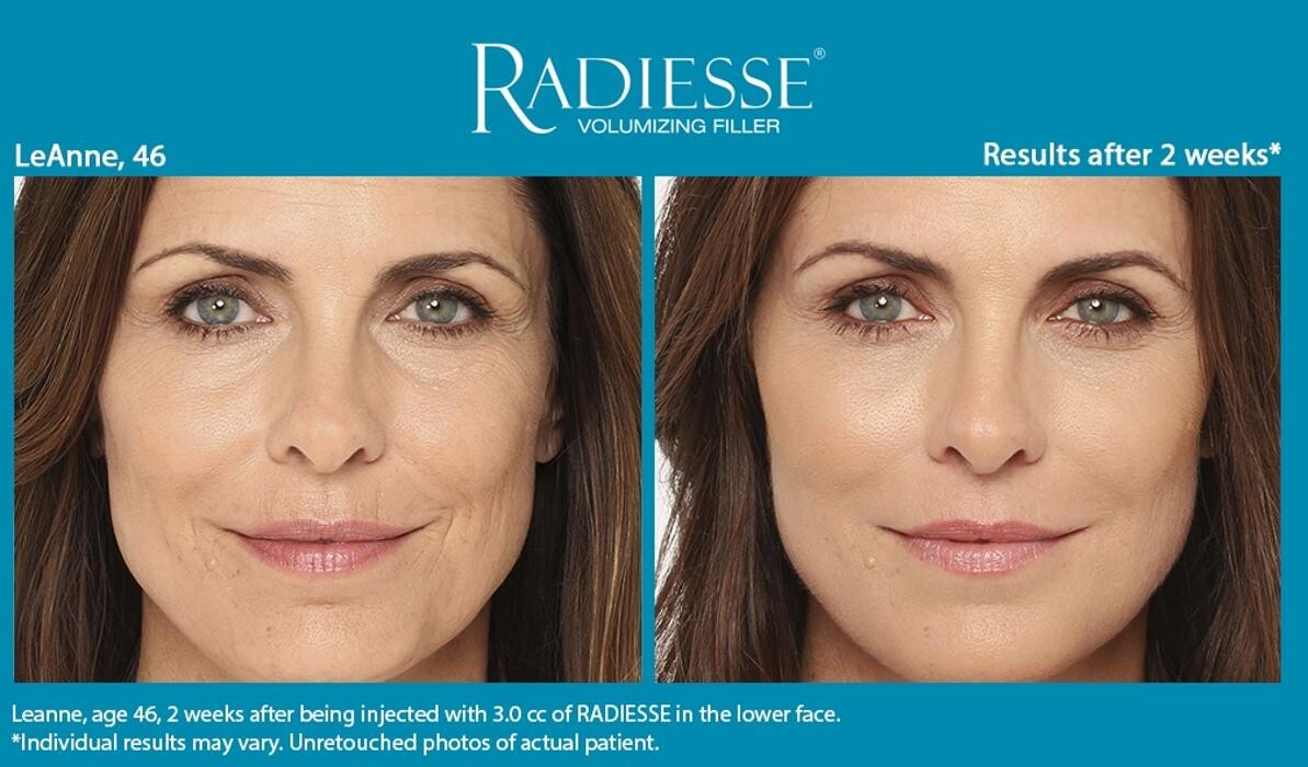 Images Subtle Aesthetics