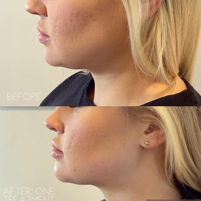 Images Subtle Aesthetics