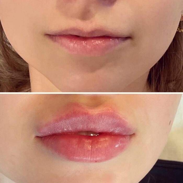 Images Subtle Aesthetics