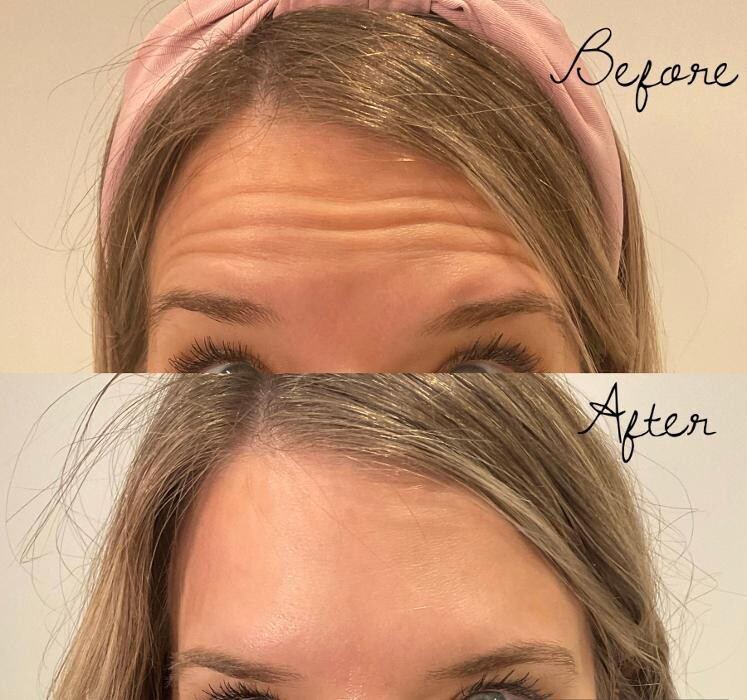 Images Subtle Aesthetics