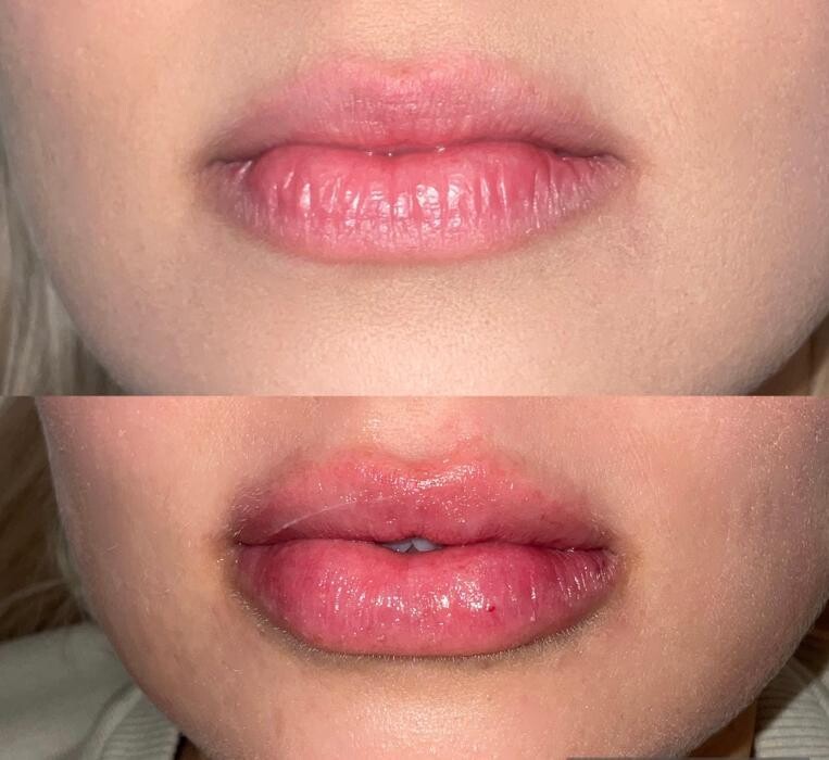 Images Subtle Aesthetics