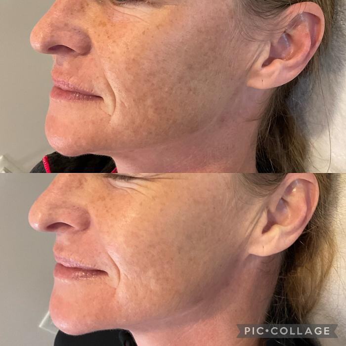 Images Subtle Aesthetics