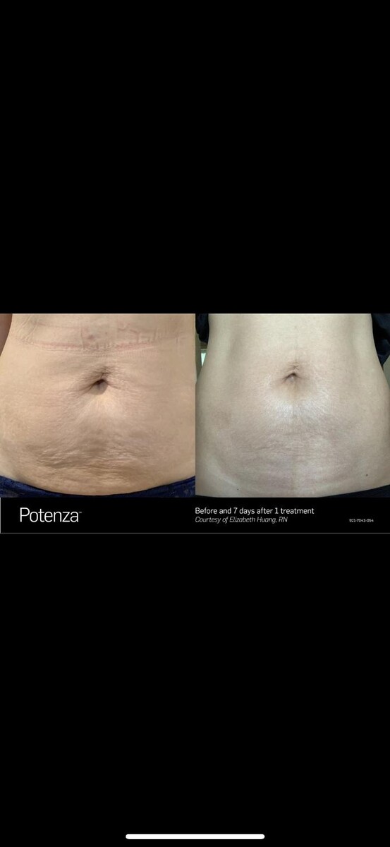 Images Subtle Aesthetics