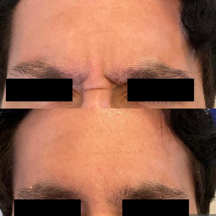 Images Subtle Aesthetics