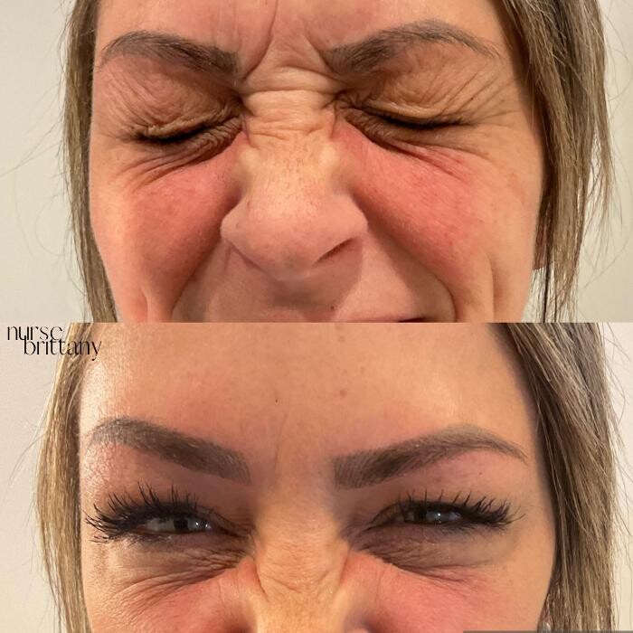 Images Subtle Aesthetics