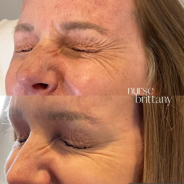 Images Subtle Aesthetics